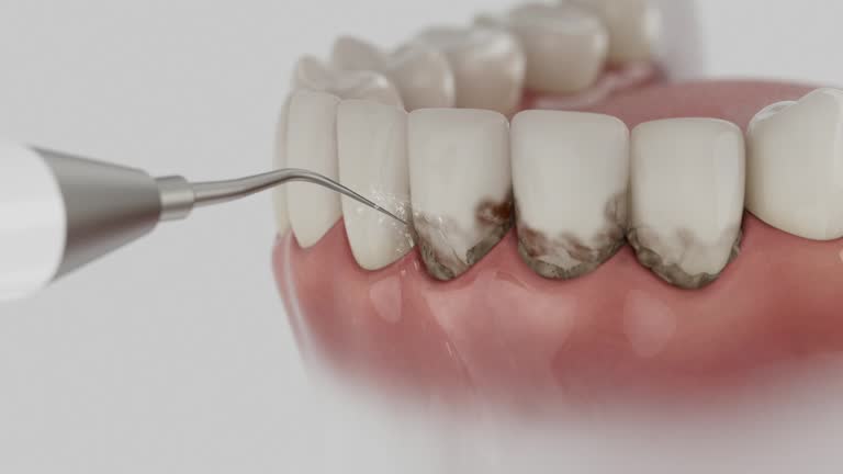 Reliable Dental Implants contractor in Prairie View, TX by Smile Center Dentistry
